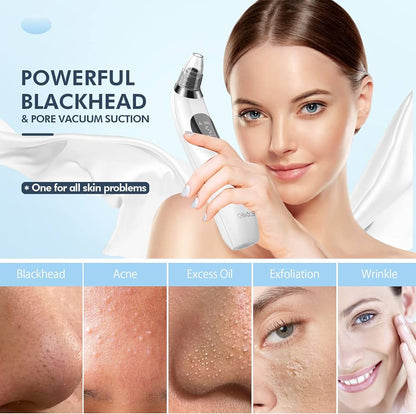 Face Vacuum Suction Blackhead Remover Machine | Deep Cleansing For Nose & Face